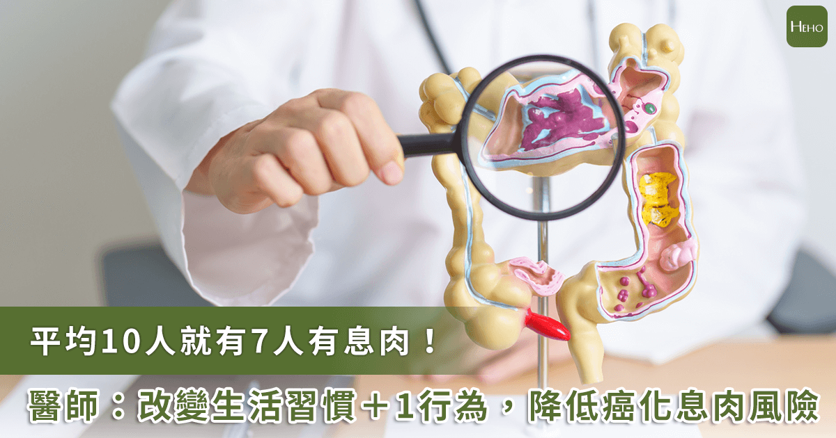 大腸癌防治關鍵！做「這件事」防息肉癌化